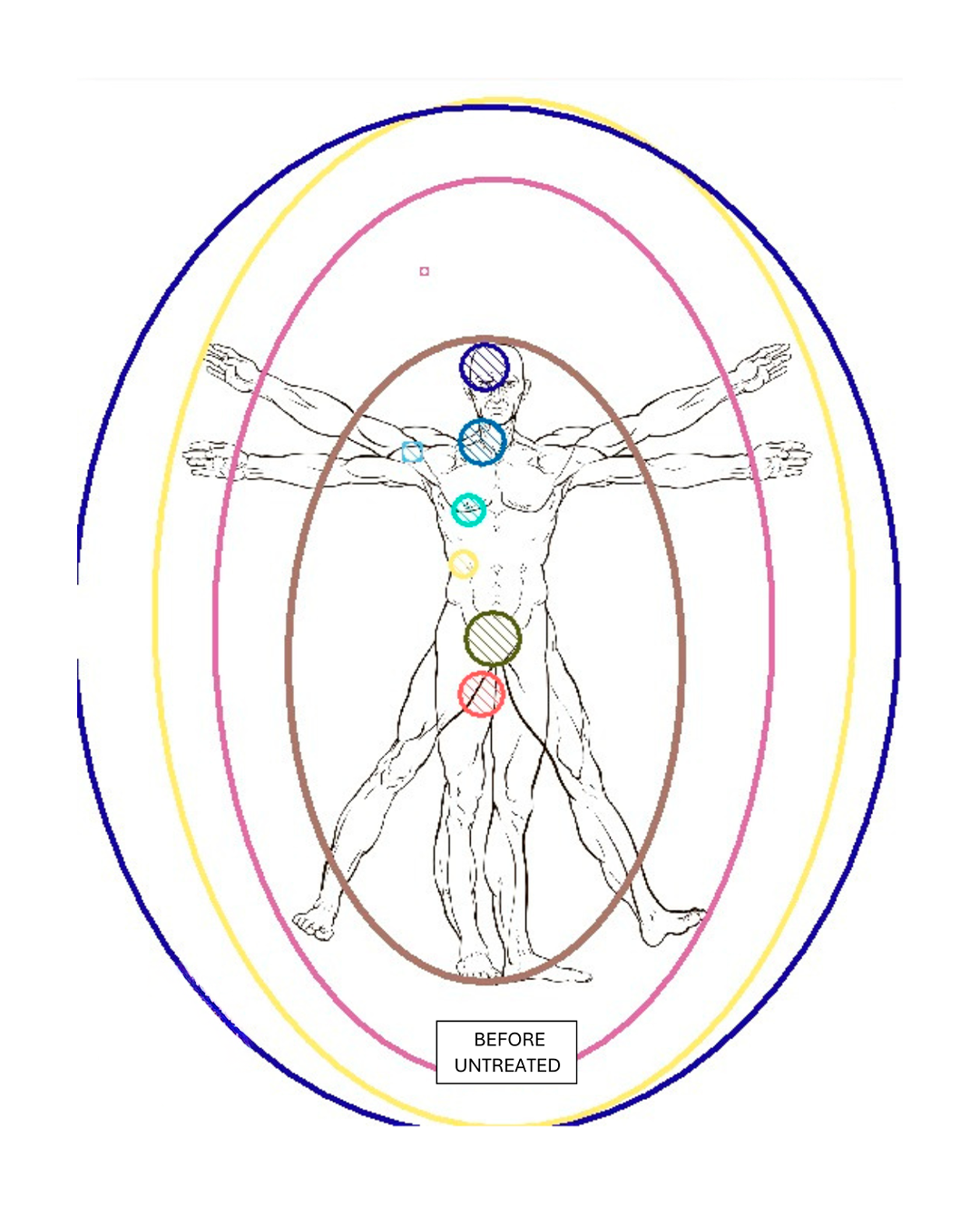 Chakra Alignment Before Treatment